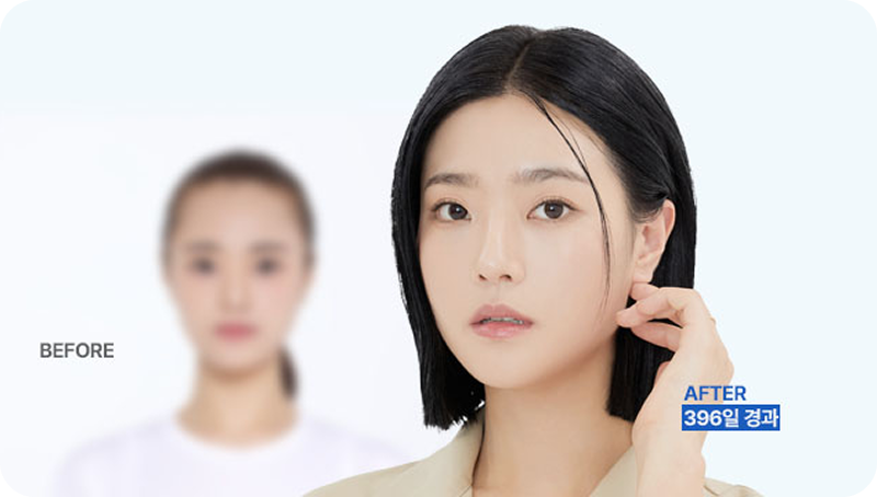넓은 얼굴 여백 삭제