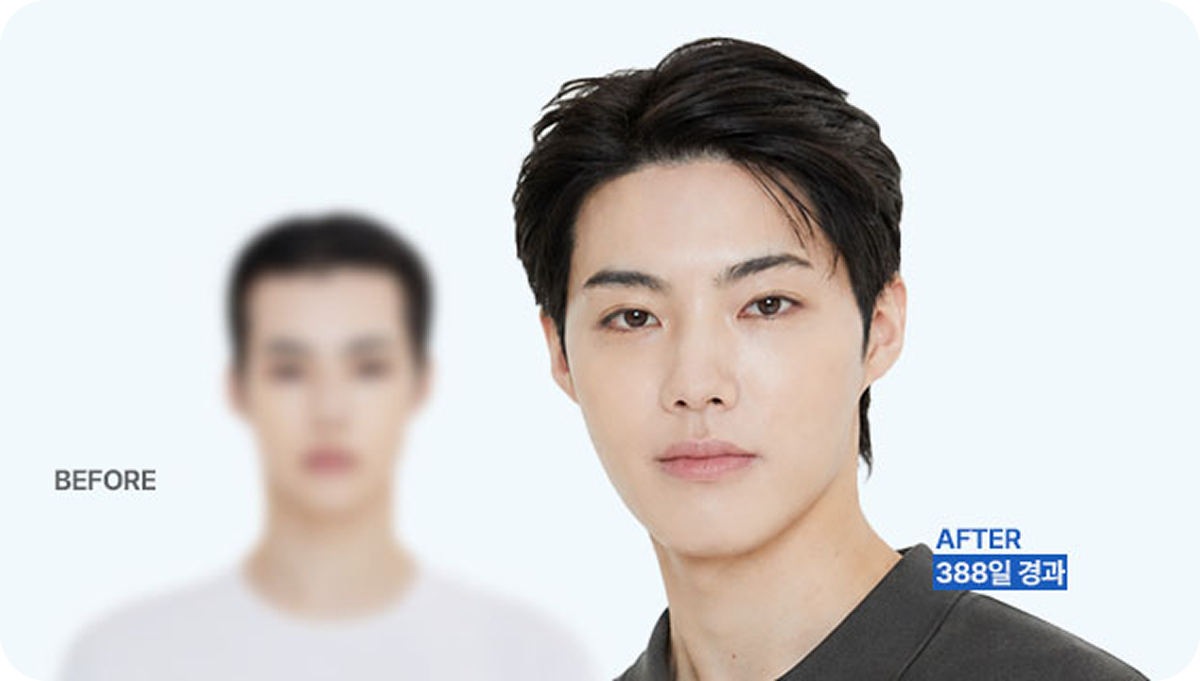 라인 변화만으로, 일본 남돌상 등극
