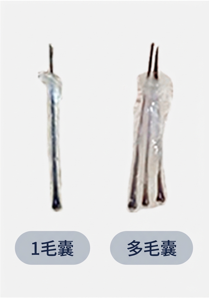低密度