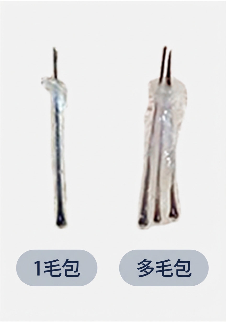 低密度