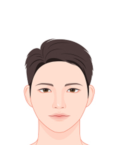 다이아몬드형