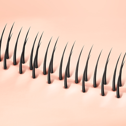 Scar cover hair transplant surgery process 02